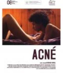 粉刺 Acné            (2008)