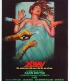 医院大屠杀 Hospital Massacre            (1981)