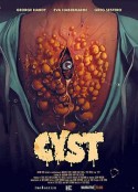 囊肿 CYST            (2020)