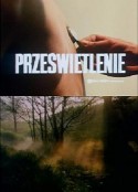 X射线 Prześwietlenie            (1974)